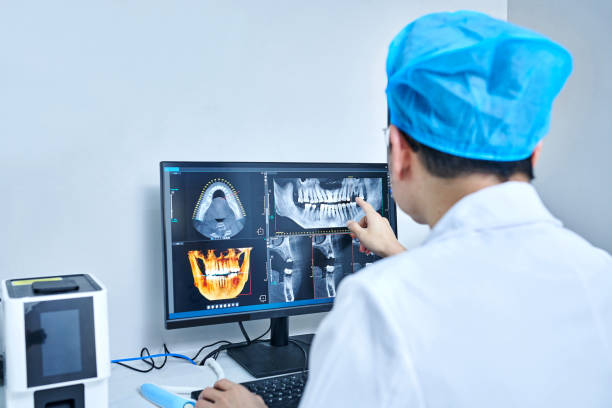 Best Emergency Wisdom Tooth Extraction in West Monroe, LA