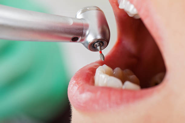 Best Emergency Pediatric Dental Care in West Monroe, LA